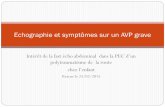Echographie et symptômes sur un AVP grave - …resuval.free.fr/FMC/FMC-15.02.25/Cas-1.pdf · Prise en charge d’une enfant de 11 ans encore incarcérée durée 10 à15 ‘ : ...