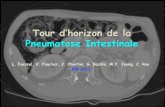 Tour d’horizon de la Pneumatose Intestinalepe.sfrnet.org/Data/ModuleConsultationPoster/pdf/2011/1/5cf16f38-1... · Tour d’horizon de la Pneumatose Intestinale L. Foessel, V. Faucher,