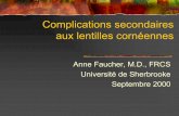 Complications secondaires aux lentilles cornéennes free/telechargements - Copie/Anne Faucher... · aux lentilles cornéennes Anne Faucher, M.D., ... − ↓AV sec à irrégularité