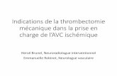 Indications de la thrombectomie mécanique dans la …copacamu.com/files/11/2018/com_vendredi/9h45_brunel-robinet.pdf · contre indication à la thrombolyse IV du fait d’un risque