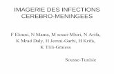imagerie des infections cérébro-méningéespe.sfrnet.org/Data/ModuleConsultationPoster/pdf/2004/1/c08e0f18-d4... · • Infections cérébrales de l'immunodéprimé • Conclusion