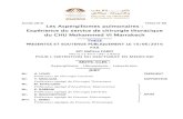 Thèse N° 99 Les Aspergillomes pulmonaires : …wd.fmpm.uca.ma/biblio/theses/annee-htm/FT/2016/these99-16.pdf · du CHU Mohammed VI Marrakech ... BEN DRISS Laila Cardiologie MANOUDI
