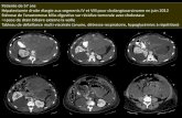 Patiente de 57 ans Hépatectomie droite élargie aux …onclepaul.net/wp-content/uploads/2011/07/comab.pdf · Normes : 0-3 mmHg GDS : Lactates = 18 pH = 6,9 Cytolyse > 4 000 UI/L