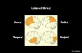 Temporal Occipital - peddycaliari.compeddycaliari.com/ · Lobe frontal Lorsque vous organisez votre journée ou défendez une idée avec des arguments, le lobe frontal est très actif.