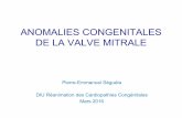 ANOMALIES CONGENITALES DE LA VALVE MITRALE · ANATOMIE NORMALE Complexe valvulaire mitral • Anneau • Feuillets • Cordages ... • Moore (Circulation 1994): 11.5 mmHg ± 4.4