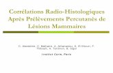 Corrélations Radio-Histologiques Après Prélèvements ...pe.sfrnet.org/Data/ModuleConsultationPoster/pdf/2008/1/2c85c242-0... · Néoplasie lobulaire avec adénose sclérosante