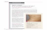 Signes cutanés de la neurofibromatose de type 1 Atlas Images en Dermatologie • Vol. V • n 2 et 3 • mars-juin 2012 66 Signes cutanés de la neurofibromatose de type 1 Cutaneous
