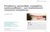 Prothèse amovible complète unimaxillaire : un traitement ...wala.elteg.net/id/media/spvol16n4p293-302.pdf · une arcade maxillaire édentée opposée à une arcade mandibulaire