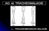 AO et TRACHEOMALACIE - college-chirped.fr · Rapport oeso-trachéal : Aspect normal Trans-section trachéale (T) et de l’œsophage (E) d’un fœtus normal La trachée a une forme