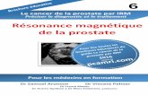 Le cancer de la prostate par IRM Préciser le diagnostic et ...prostatecancermri-accurate-diagnosistreatment.com/wp-content/... · 8 | Page L’importance de la présence d’un nodule