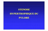 stenose du pylore - Epu B AMIENS(FRANCE) du ¢  ¢â‚¬¢ Hypertrophie progressive des fibres musculaires du