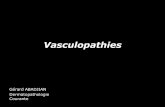 Vasculopathies - epathologies.com · –Vasculite granulomateuse avec éosinophilie et asthme, riche en éosinophiles, atteignant les vaisseaux de moyen calibre dermique profond,