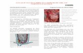 ATLAS D’ACCES LIBRE EN CHIRURGIE ORL ET CERVICO-FACIALE · Une connaissance parfaite des rapports anatomiques entre le nerf laryngé inférieur et la gouttière trachéo-oesophagienne,