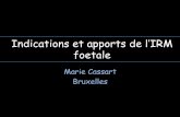 Marie Cassart Bruxelles · 2015-12-14 · Indications d’IRM cérébrale • Ventriculomégalie (36%) • Infections (20%) (CMV, toxoplasmose) > Le rôle de l’IRM est: - de préciser