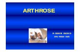 ARTHROSE - cours-examens.org · Seulement après une certaine distance = 1 Très rapidement et de façon croissante = 2 • Pour vous relever d’un siège sans l’aide des bras