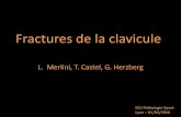 Fractures de la clavicule - Centre Albert Trillat | …orthopedie-lyon.fr/wp-content/uploads/2012/02/DIU-DU...Fractures de la clavicule : 2,6% à 5% de toutes les fractures dans la