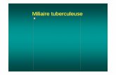 Miliaire   Miliaire tuberculeuse (1) ¢â‚¬¢ Le diagnostic de miliaire requiert un clich£© thoracique
