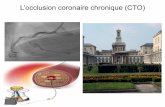 L’occlusion coronaire chronique (CTO) ... CTO retrograde La procédure de désobstruction des occlusions chroniques (CTO) par voie rétrograde, utilise les collatérales qui viennent