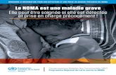 OMS Brochure Noma 24Le noma est une maladie grave, elle peut être soignée si elle est prise en charge précocement : brochure d’information pour une détection et une prise en