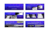 La radiographie standard Imagerie des tendonsperso.numericable.fr/bensimonj/PolyParis/11Radier.pdf · 2011-03-25 · Imagerie des tendons Catherine RADIER RIM Maussins -Nollet La