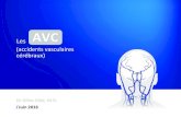AVCL’AVC ischémique ü Se reconnaît cliniquement par un déﬁcit neurologique, focal ou global, d’installaon soudaine, sans cause apparente autre que vasculaire; ü Déﬁcit