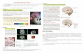 Différentes aires cérébrales pour l’audition : Document 3 : On … · 2020-03-09 · Différentes aires cérébrales pour l’audition : les messages nerveux élaborés au niveau