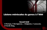 Lésions méniscales du genou à l’IRMuclimaging.be › ... › des2_2018_1_irm...meniscales.pdfDe Smet AA, MR diagnosis of Meniscal tears of the knee: importance of high signal