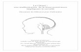 Le Chiari - Overblogdata.over-blog-kiwi.com/0/83/98/82/201311/ob_fd30c...Image tirée du livre « Anatomie et physiologie humaines » de E. Marieb et G. Laurendeau, ERPI 1992 Limites