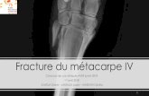 Fracture du métacarpe IV - AVEF Junioravefjunior.org/wp-content/uploads/2018/04/envt_cas-clinique_congre… · Basic and clinical sciences of the equine athlete, Elsevier, 1364p.