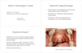 Atelier: Pathologies ‘molles’ Objectifs d’apprentissage€¦ · bulleuses • EP • pemphigus • pemphygoïde Carcinome épidermoïde Toxidermie aphtoïde Carences B12, folates
