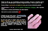 Onychomadèse - ONCLE PAULonclepaul.net/wp-content/uploads/2011/07/crocaFILEminimizer1.pdfExamen histologique d’un polype du colon sigmoïde: dilatation kystique des glandes et des