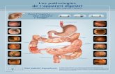Les pathologies de l’appareil digestif - SFED · 2014-11-04 · Les pathologies de l’appareil digestif visualisées par la vidéo capsule PillCam® La Plate-forme PillCam® vous