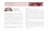 Le repositionnement chirurgical de la lèvre supérieure.thedentalist.fr/wp-content/uploads/2016/05/Repositionnem... · 2020-05-28 · d'un sourire gingival. En effet, plusieurs techniques