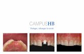 Campus HB- PDF V2 · La préparation parodontale pré implantaire et maintenance : clé du succès à long terme. CAMPUSHB Partager, échanger le savoir Les différentes thématiques