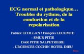 ECG normal et pathologique…medesim.fr/doc/cours2011DU2/Module1/tr rythm REVU fl.pdfECG normal et pathologique… Troubles du rythme, de la conduction et de la repolarisation Patrick
