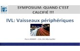 IVL: Vaisseaux périphériques · Baseline ejection fraction STS 0/0 52.6 ± 12.4 8.8 ± 5.5 IVI- catheter size 5.0 x 60 mm 6.0 x 60 mm 6.5 x 60 mm 7.0 x 60 mm Number of pulses per