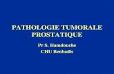 PATHOLOGIE TUMORALE PROSTATIQUEuniv.ency-education.com/uploads/1/3/1/0/13102001/... · Hyperplasie nodulaire de la prostate • L’HNP (adénomyome): lésion dystrophique qui représente