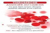 THROMBOSE...signes et les symptômes de la thrombose associée au cancer, car ceux-ci peuvent ne pas être évidents. Il est possible de croire que ces symptômes sont liés au cancer