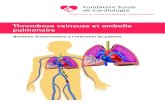 Thrombose veineuse et embolie pulmonaire · PDF file 2019. 3. 15. · thrombose veineuse profonde et que l’on redoute une embolie pulmonaire, on commencera en général par explorer