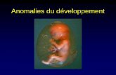 Anomalies du développement · Anomalies du développement Les troubles du développement prénatal engendrent des malformations congénitaleset constituent une cause importante de