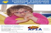 SYNDROME D’ANGELMAN Maladie génétique rare · Le syndrome d’Angelman est une maladie génétique rare, responsable d’un retard psychomoteur important et d’une déficience