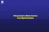 Néoplasies Mammaires IntraEpithélialesepathologies.com/sem/Sein1204/Neo Intraepith.pdfModèle Hypothétique de Cancérogenèse mammaire Luminale (RE+) (d’après Simpson et coll.