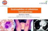 Eosinophiles et aeintes respiratoires · CEREO-Centre de Référence des Syndromes Hyperéosinophiliques ... Wechsler, NEJM 2017 3. Comarmond, AR 2013 4. Josselin-Mahr, Rheumatology