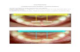 MALPOSITIONS (cf dysharmonie dento-maxillaire, cf ...from. MALPOSITIONS (cf dysharmonie dento-maxillaire,