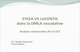 EYLEA VS LUCENTIS dans la DMLA exsudative · Étude prospective, multicentrique (durée: 1 an?) Patients naïfs de tout traitement Présentant une DMLA exsudative AV 20/25 et 20/250