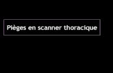 Pièges en scanner thoraciqueonclepaul.fr/wp-content/uploads/2011/07/Pièges-en-scanner-thoraciq… · Homme de 67 ans Bilan pré-opératoire d’un anévrisme de l’aorte thoracique