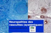 Neuropathies des vasculites (systémiques)€¦ · axonal degeneration • Combined biopsy of nerve and muscle > nerve only, by 27% (Vital et al. JPNS 2006) PNS Classification of