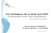 Les techniques du scanner pré-TAVI ...CHU_ Hôpitaux de Rouen -page 1 Les techniques du scanner pré-TAVI (TranscatheterAorticValve Implantation) JFICV Deauville 22-24/6/2017 Roxane