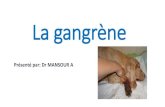 La gangrène - fac.umc.edu.dz · infectieux (antibiotiques, sérums antigangreneux polyvalents de l'Institut Pasteur diluer 15 ml de sérum antigangréneux dans 500 ml de soluté