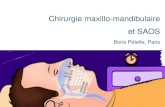 Chirurgie maxillo-mandibulaire et SAOSarchives.jprs.fr/sites/default/files/prez/bordeaux_amm.pdfA systematic review and meta-analysis JC. Holty, C. Guilleminault Sleep 201027 study,